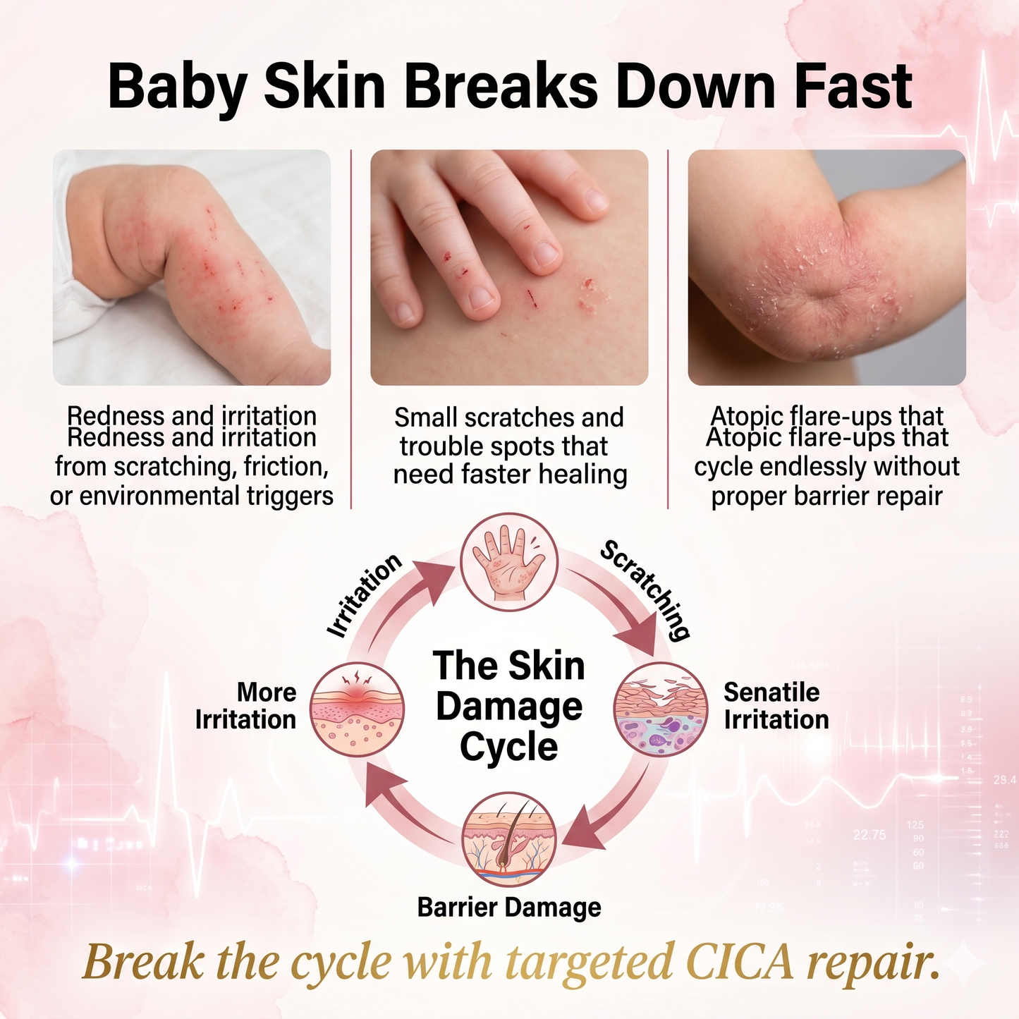 Mongdies Baby Cica Repair Cream 50g | SOS Skin Barrier | Drool Rash & Irritation | EWG Green
