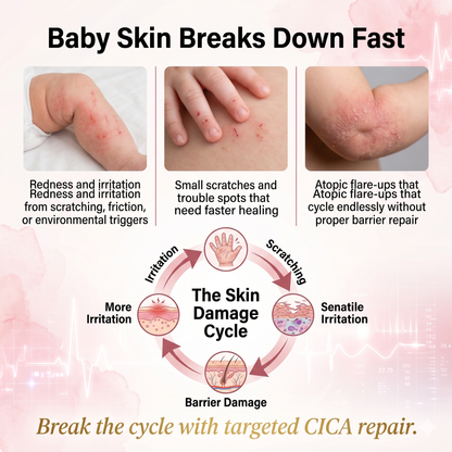 Mongdies Baby Cica Repair Cream 50g | SOS Skin Barrier | Drool Rash & Irritation | EWG Green